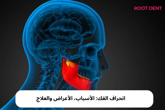 انحراف الفك: الأسباب، الأعراض والعلاج