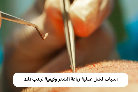 أسباب فشل عملية زراعة الشعر وكيفية تجنب ذلك