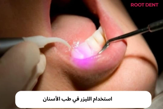 استخدام الليزر في طب الأسنان