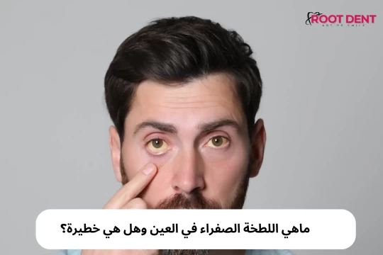 ماهي اللطخة الصفراء في العين وهل هي خطيرة؟