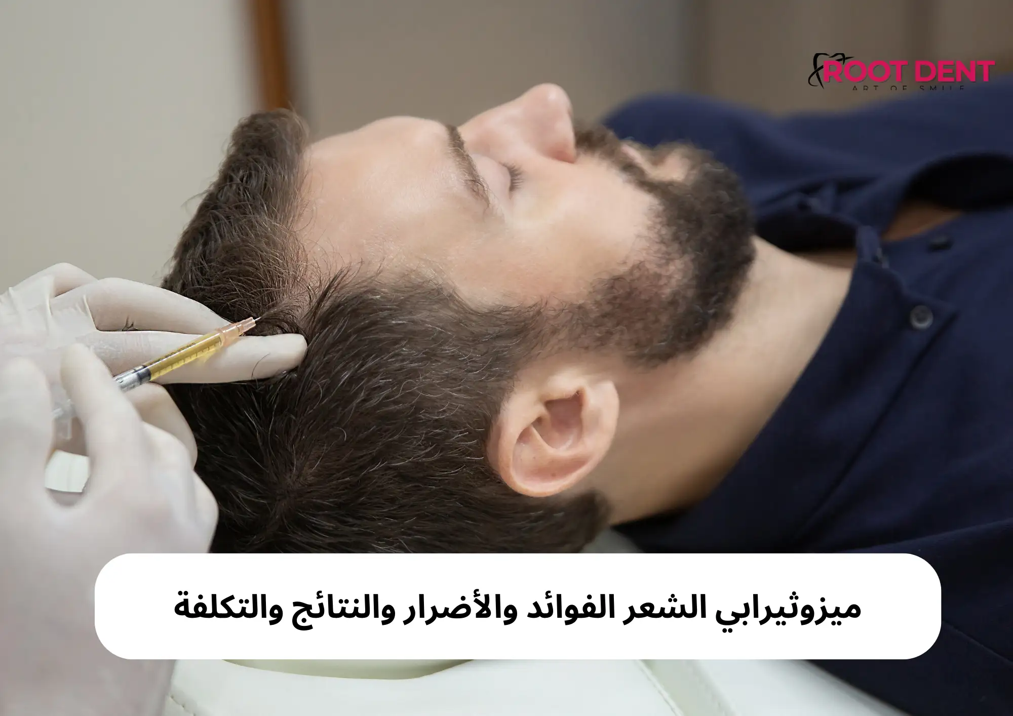 ميزوثيرابي الشعر الفوائد والأضرار والنتائج والتكلفة