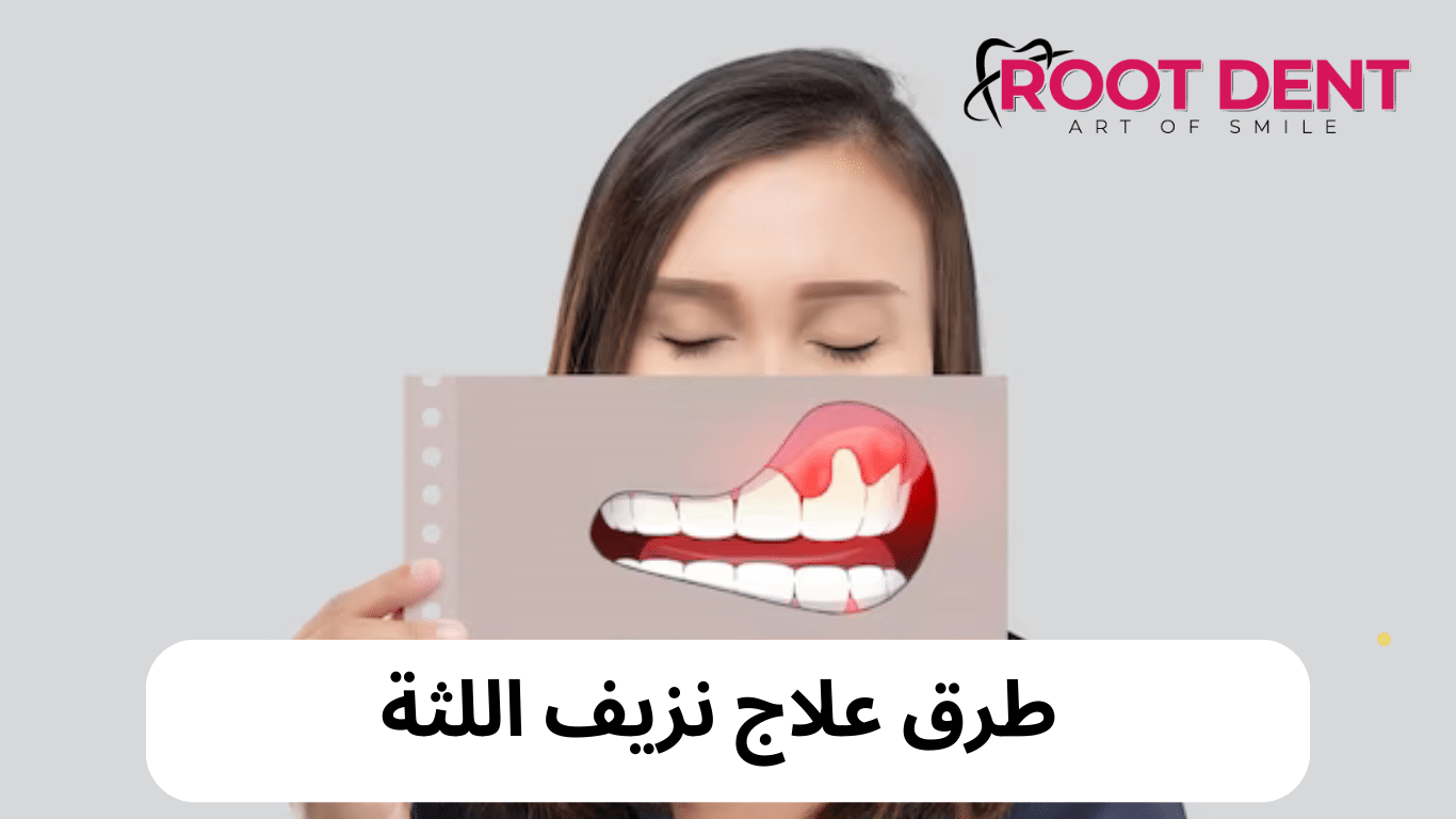 علاج نزيف اللثة, اسباب نزيف اللثة, هل نزيف اللثة خطير