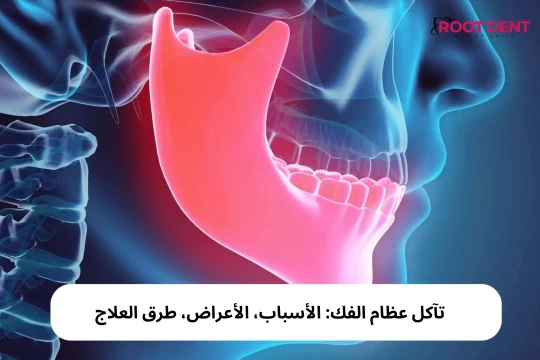 تآكل عظام الفك: الأسباب، الأعراض، طرق العلاج