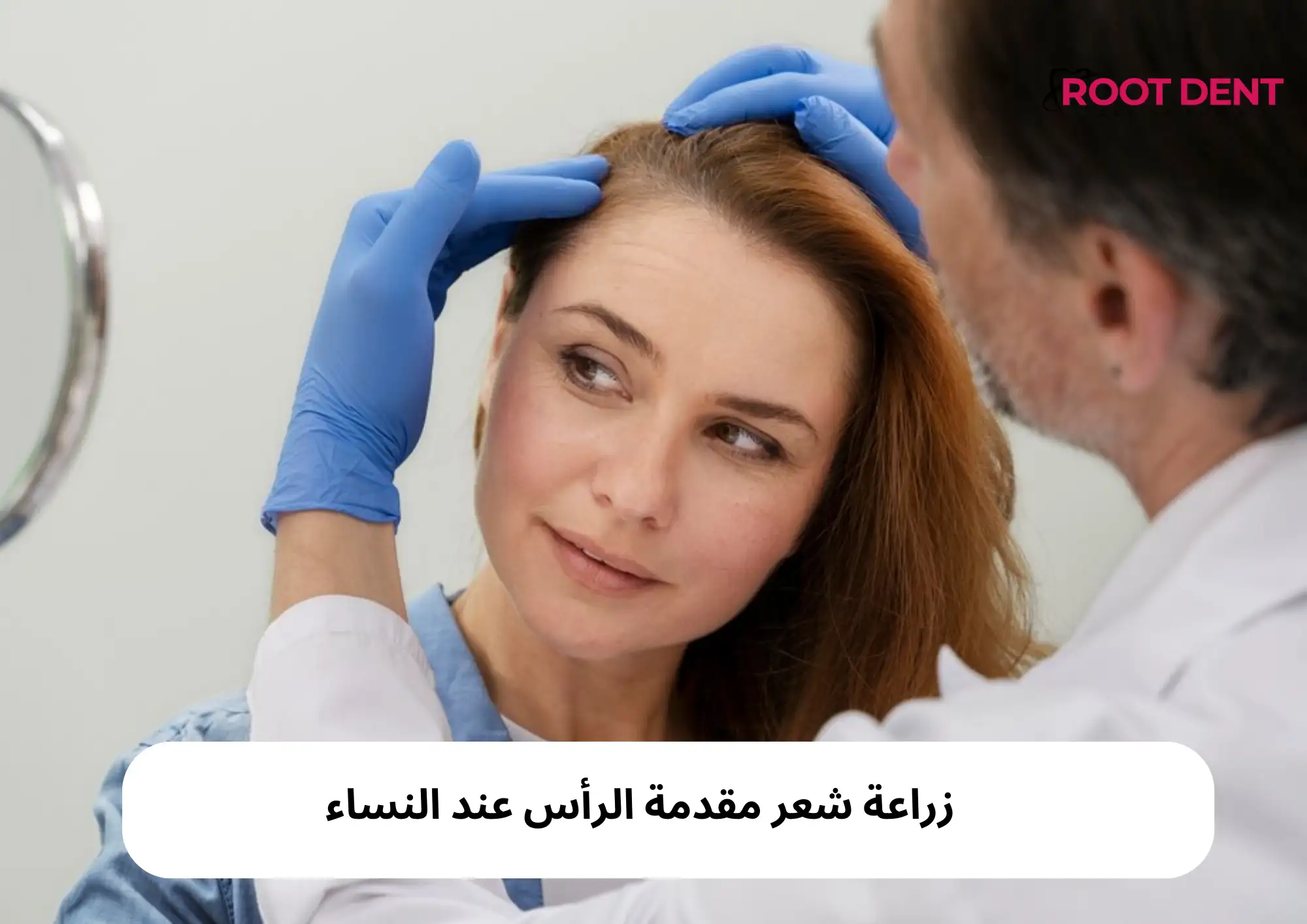 زراعة شعر مقدمة الرأس عند النساء