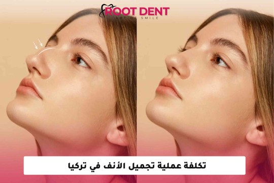 تكلفة عملية تجميل الأنف في تركيا