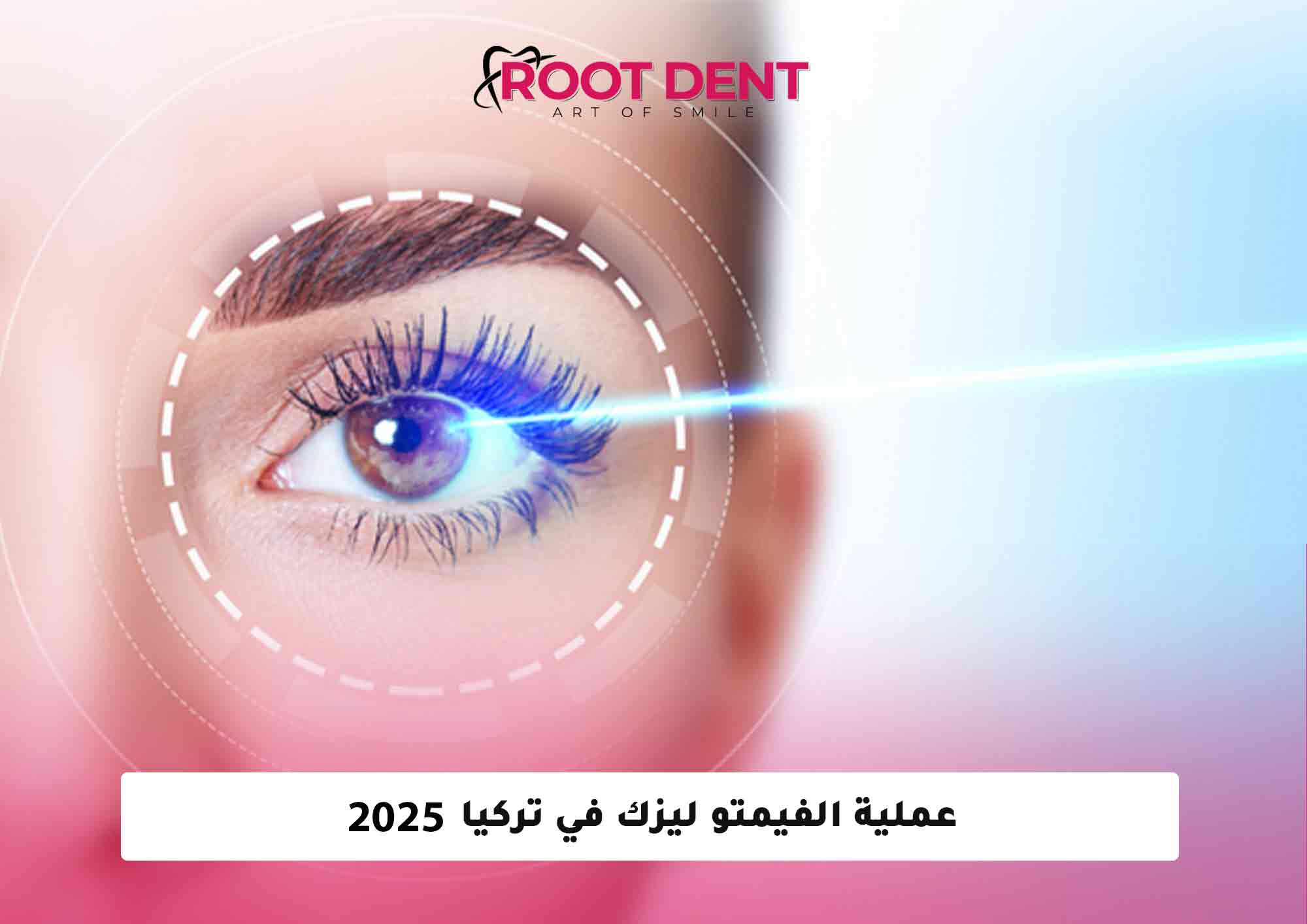 عملية الفيمتو ليزك في تركيا 2025