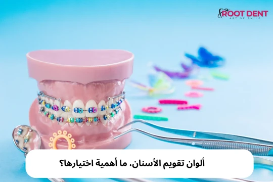 ألوان تقويم الأسنان، ما أهمية اختيارها؟
