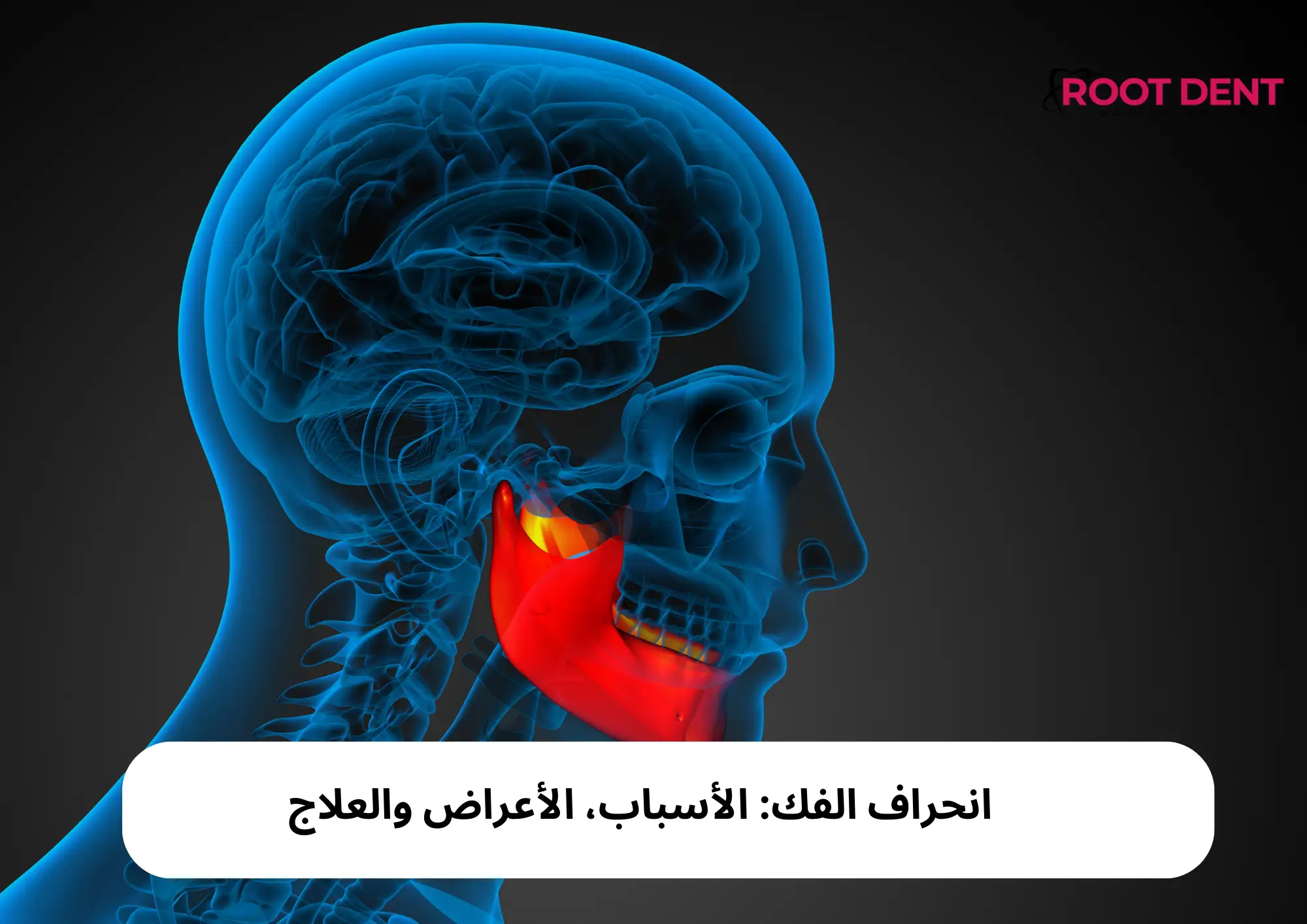 انحراف الفك: الأسباب، الأعراض والعلاج