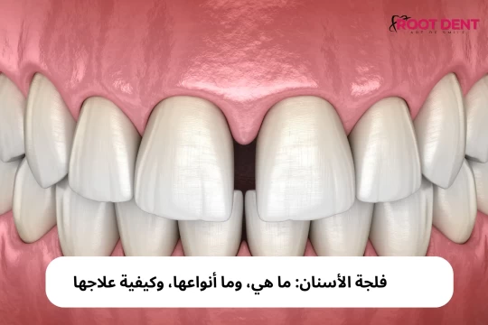 فلجة الأسنان: ما هي، وما أنواعها، وكيفية علاجها