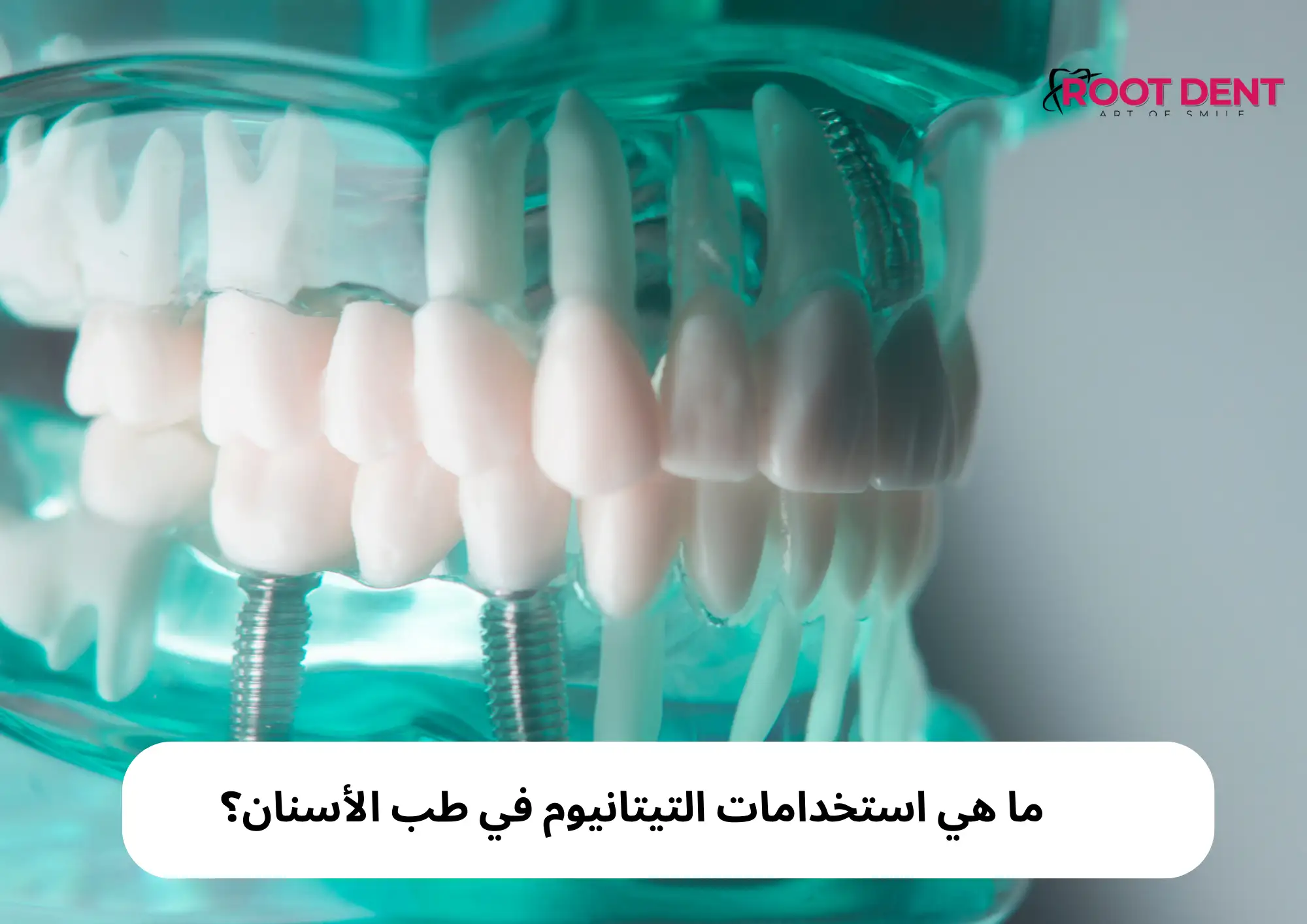 ما هي استخدامات التيتانيوم في طب الأسنان؟