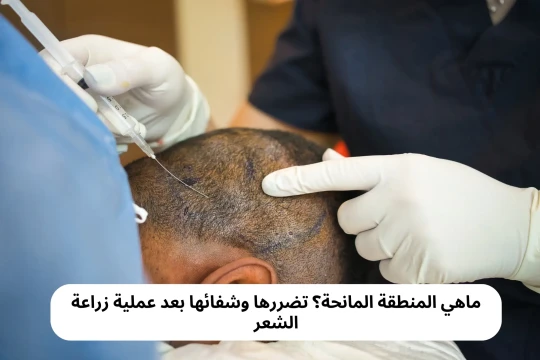 ماهي المنطقة المانحة؟ تضررها وشفائها بعد عملية زراعة الشعر