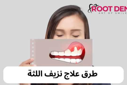 علاج نزيف اللثة, اسباب نزيف اللثة, هل نزيف اللثة خطير