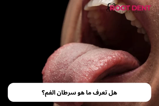 أعراض سرطان الفم و أسبابه وما هي طرق الوقاية منه؟