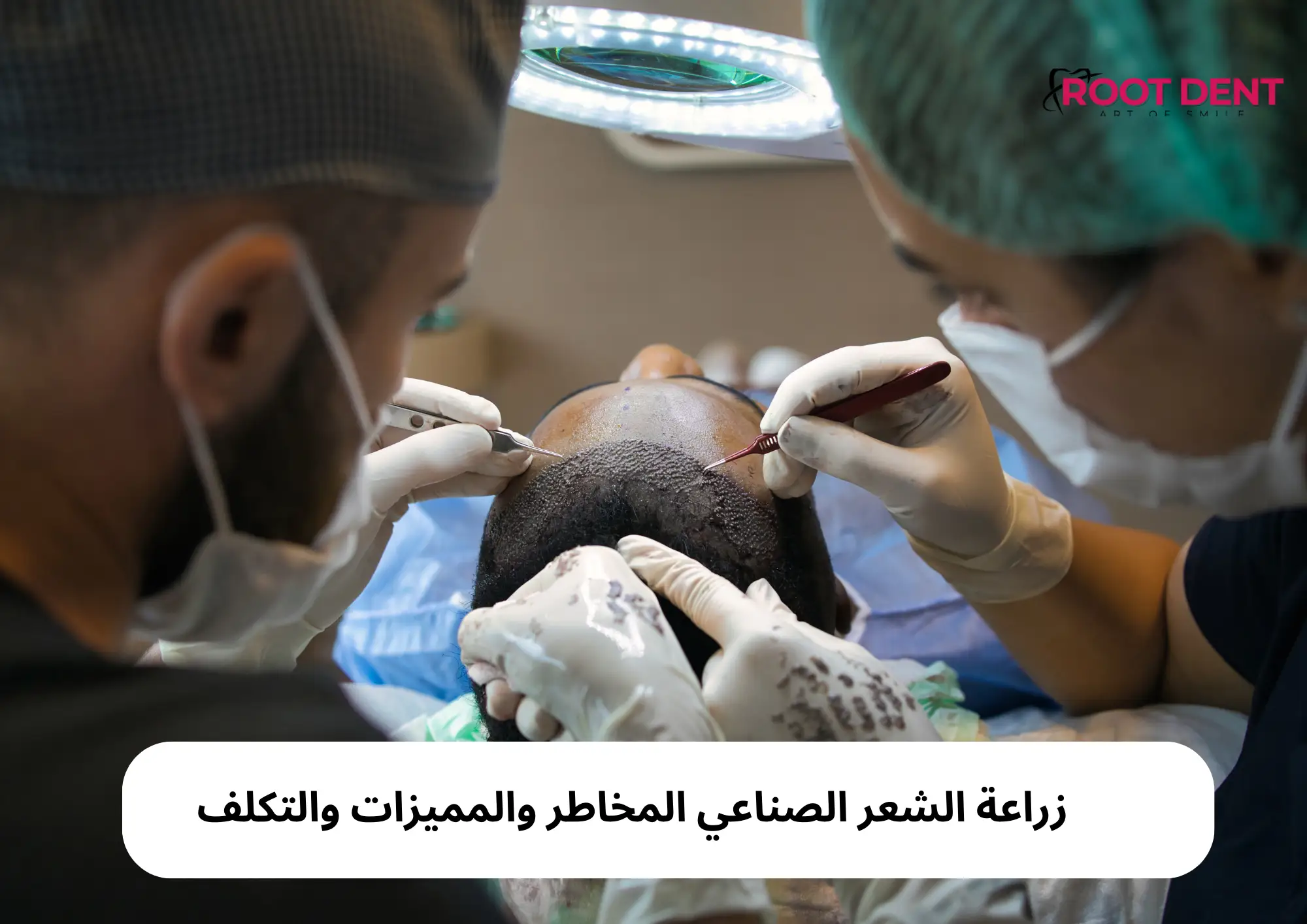 زراعة الشعر الصناعي المخاطر والمميزات والتكلف