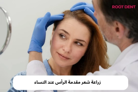 زراعة شعر مقدمة الرأس عند النساء