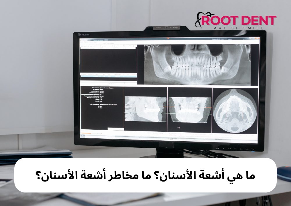 شكل خراج الأسنان في الأشعة, ما هي اشعة الاسنان؟