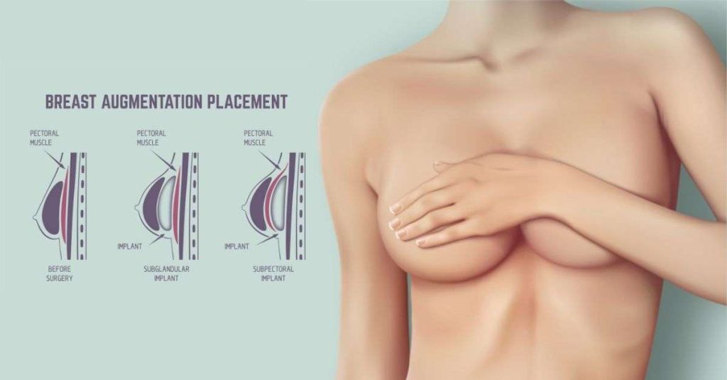 breast-augmentation-surgery-in-vadodara-1024x535