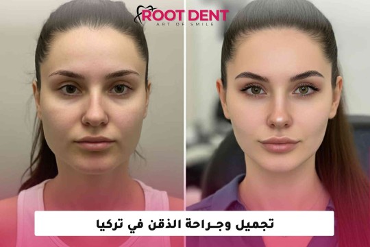 تجميل وجراحة الذقن في تركيا