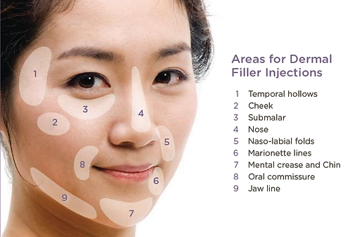 face filler site locations