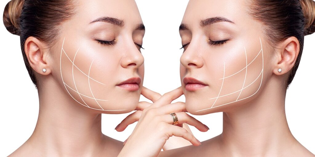 Facial-Liposuction-1024x512