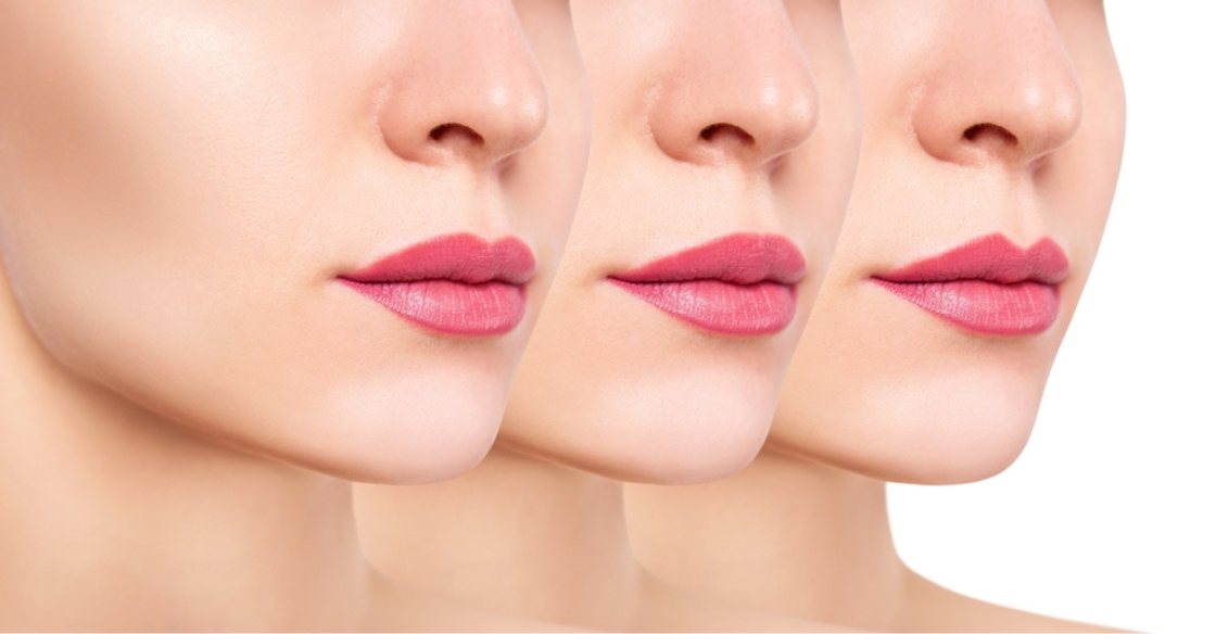 featured-lip-filler-shapes