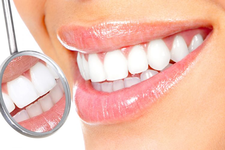 Teeth cleaning and polishing