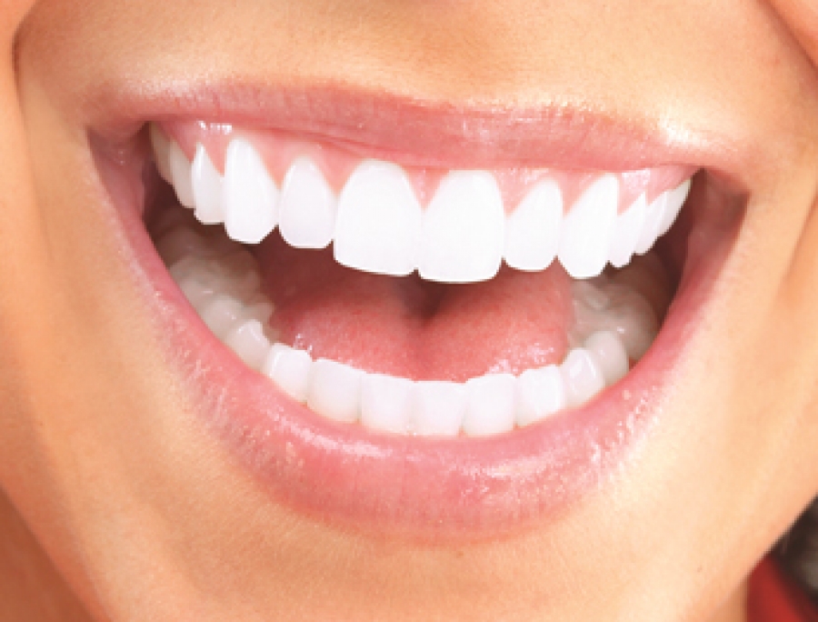 كم اسعار اسنان الزيركون في تركيا ؟ ما هي اشكال تلبيسات الاسنان ؟