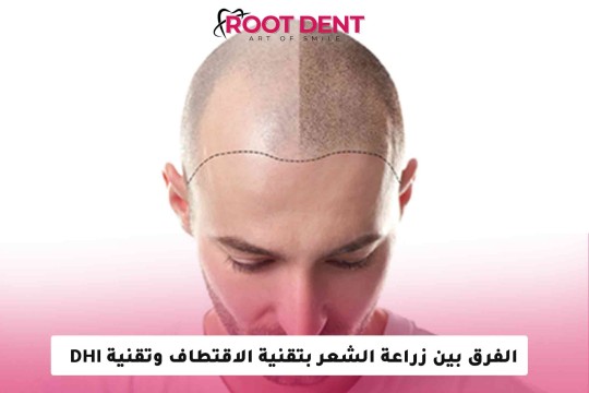 الفرق بين زراعة الشعر بتقنية الاقتطاف وتقنية DHI