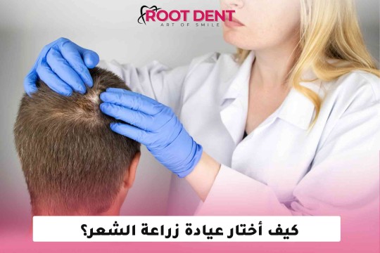 كيف أختار عيادة زراعة الشعر؟