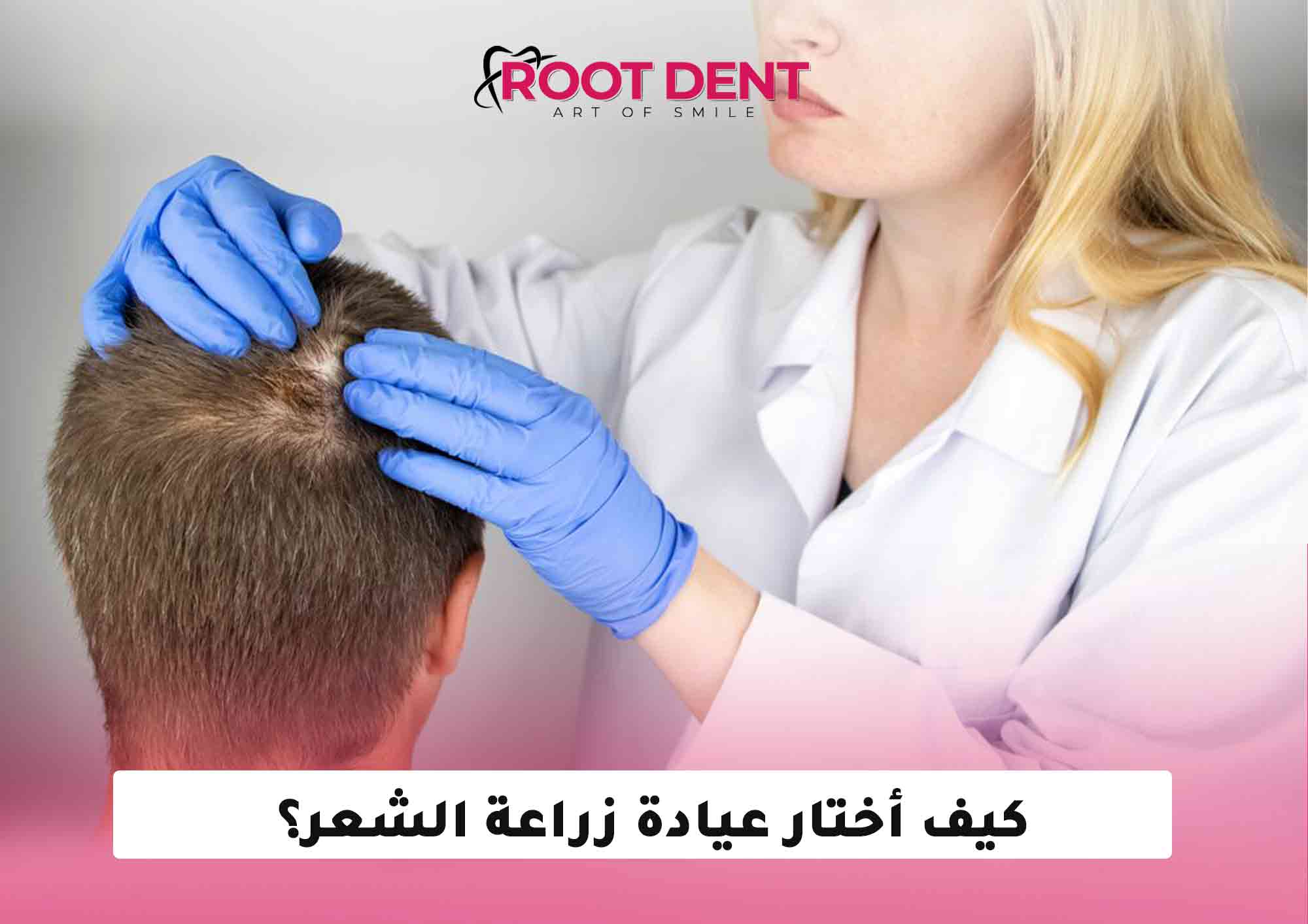 كيف أختار عيادة زراعة الشعر؟