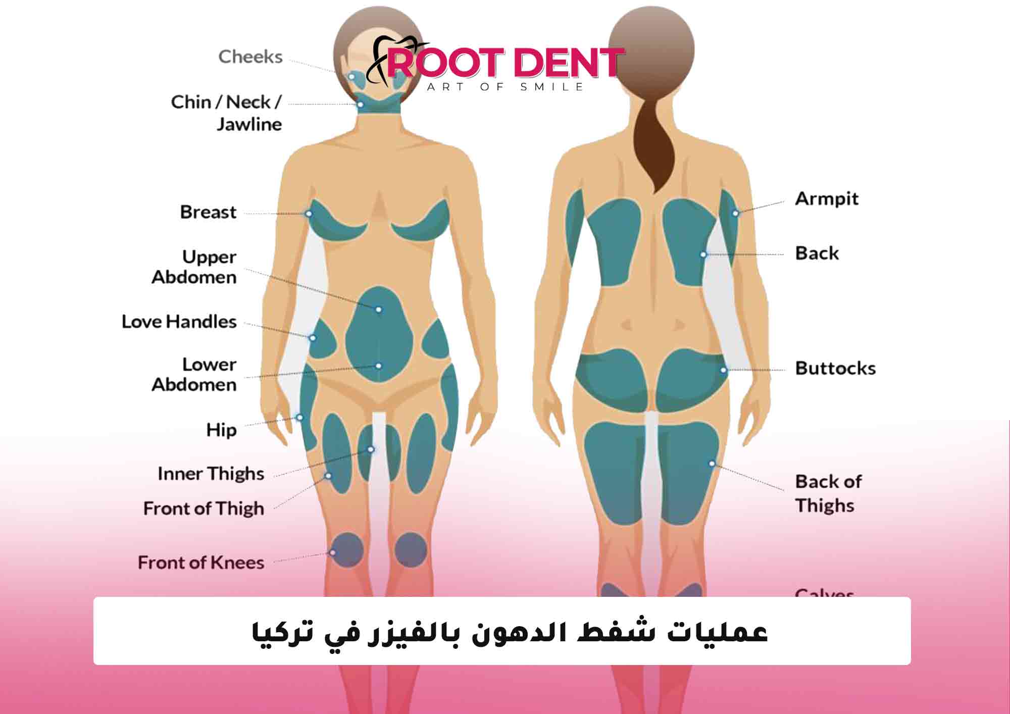 عمليات شفط الدهون بالفيزر في تركيا 2025